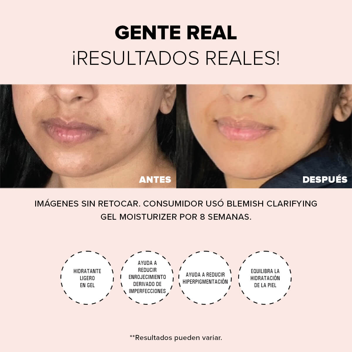 BLEMISH CLARIFYING GEL MOISTURIZER(HDIRATANTE FACIAL EN GEL)